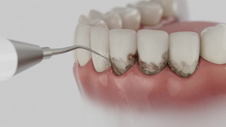 Trusted Teeth Cleaning And Checkup service in Paramus, NJ - Dentist Open Now